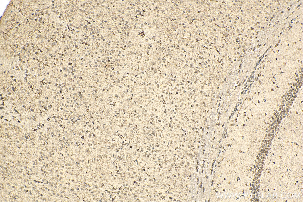 Immunohistochemistry (IHC) staining of mouse brain tissue using DLX5 Monoclonal antibody (67111-1-Ig)