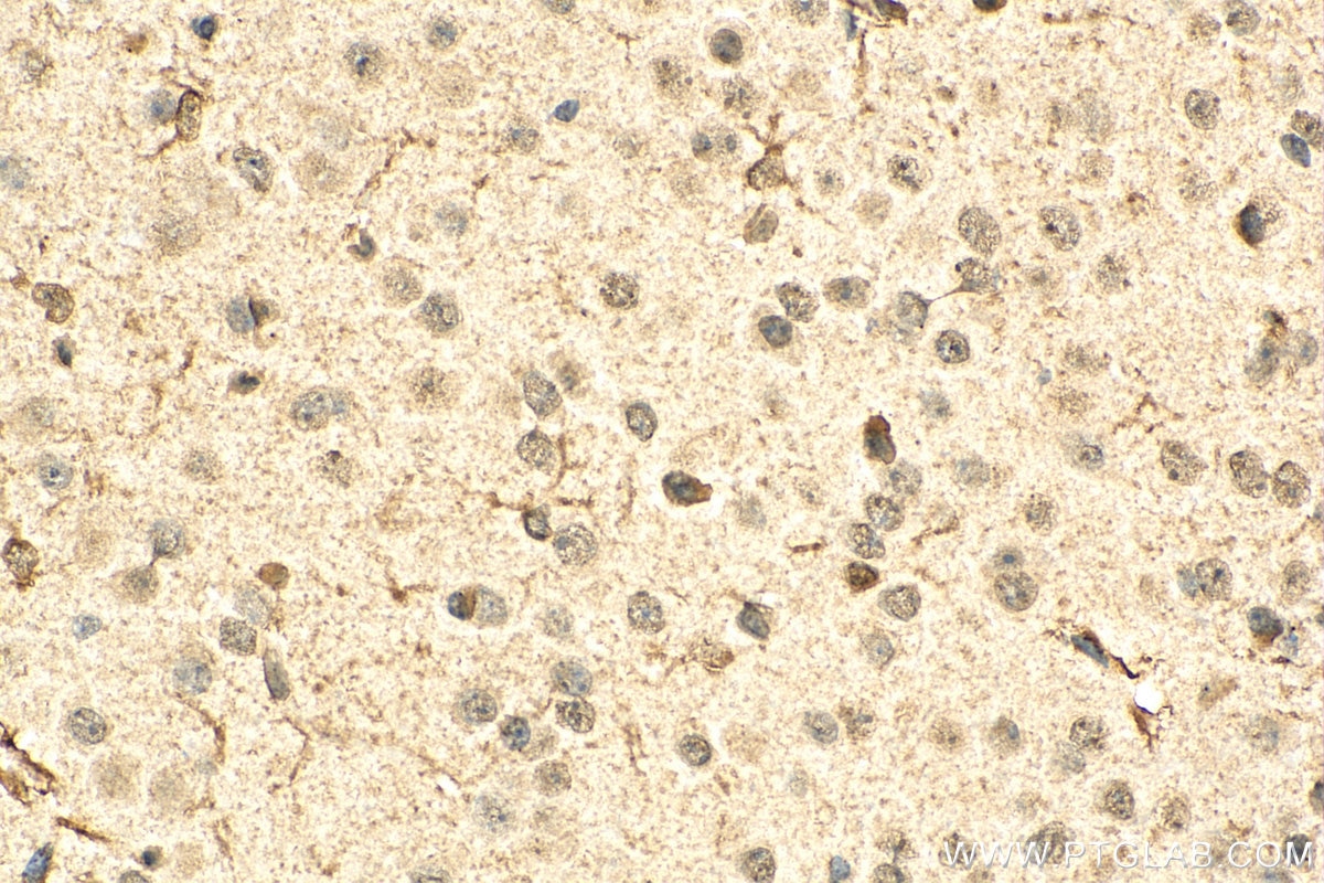 Immunohistochemistry (IHC) staining of mouse brain tissue using DLX5 Monoclonal antibody (67111-1-Ig)