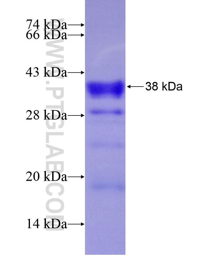 DLX5 fusion protein Ag17040 SDS-PAGE