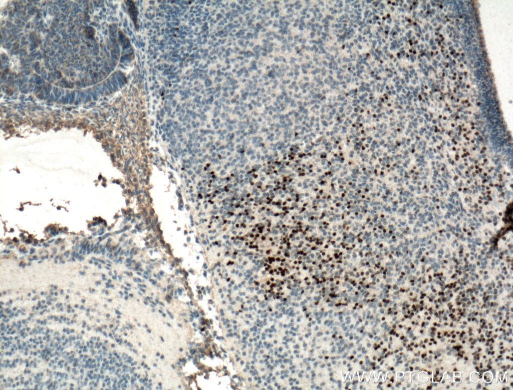 Immunohistochemistry (IHC) staining of mouse embryo tissue using DLX6 Polyclonal antibody (23216-1-AP)