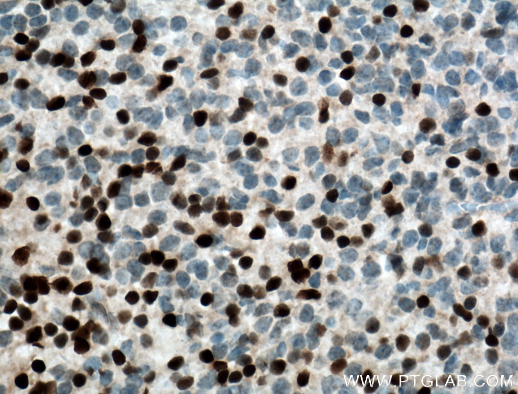 Immunohistochemistry (IHC) staining of mouse embryo tissue using DLX6 Polyclonal antibody (23216-1-AP)