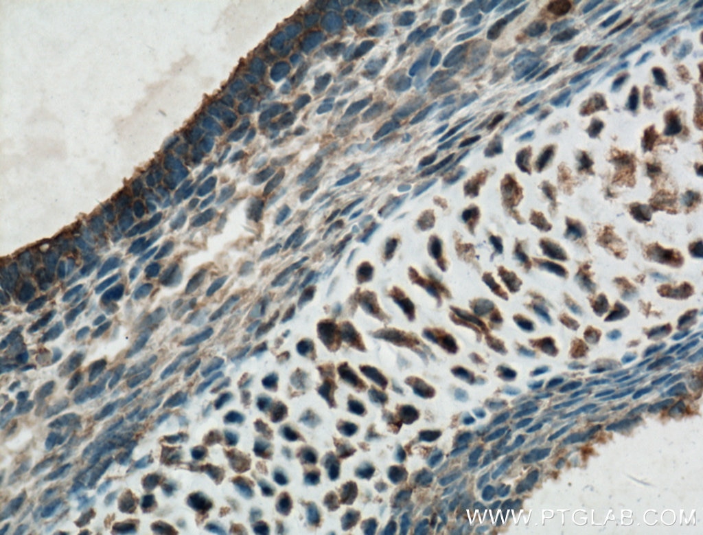 Immunohistochemistry (IHC) staining of mouse embryo tissue using DLX6 Polyclonal antibody (23216-1-AP)
