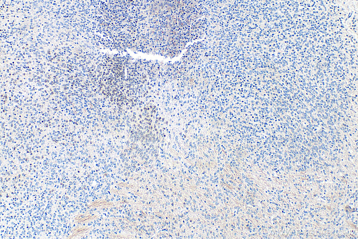 Immunohistochemistry (IHC) staining of mouse embryo tissue using DLX6 Recombinant antibody (85946-1-RR)