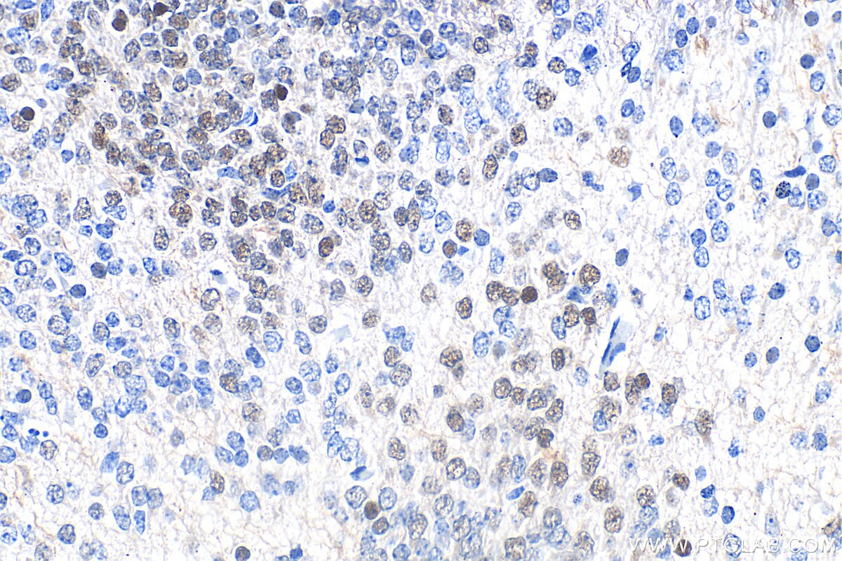 Immunohistochemistry (IHC) staining of mouse embryo tissue using DLX6 Recombinant antibody (85946-1-RR)