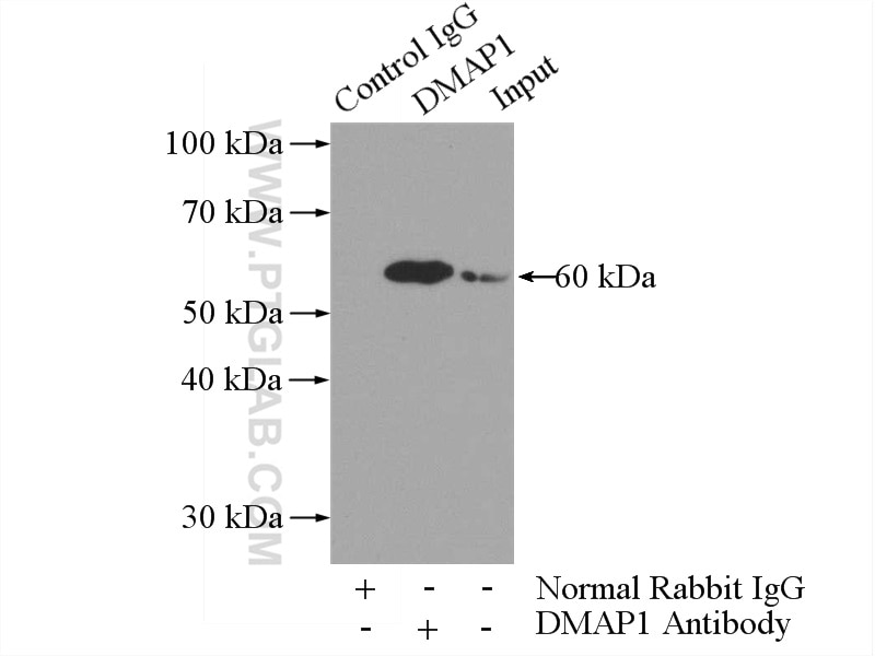 Immunoprecipitation (IP) experiment of COLO 320 cells using DMAP1 Polyclonal antibody (10411-1-AP)