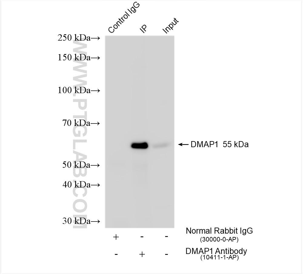 Immunoprecipitation (IP) experiment of COLO 320 cells using DMAP1 Polyclonal antibody (10411-1-AP)