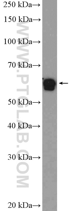 WB analysis of COLO 320 using 10411-1-AP