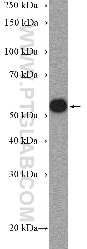 Western Blot (WB) analysis of HeLa cells using DMAP1 Polyclonal antibody (10411-1-AP)