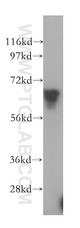 Western Blot (WB) analysis of HeLa cells using DMAP1 Polyclonal antibody (10411-1-AP)