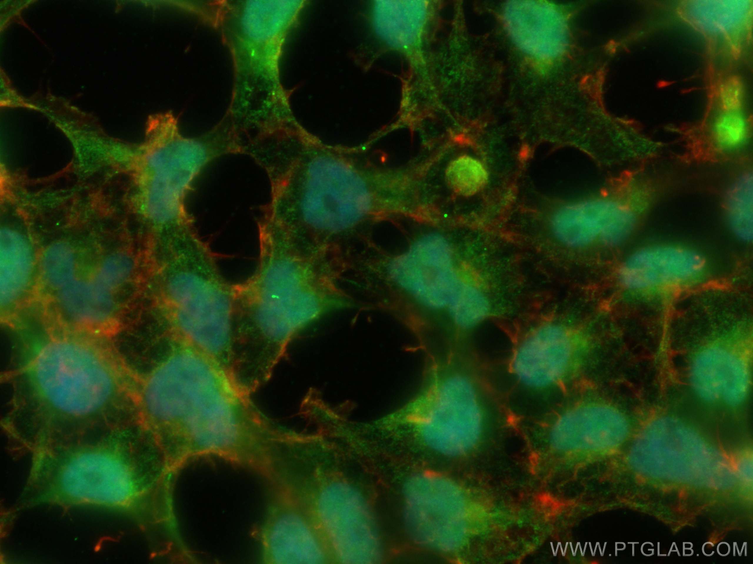 Immunofluorescence (IF) / fluorescent staining of HEK-293 cells using DMAP1 Monoclonal antibody (67183-1-Ig)