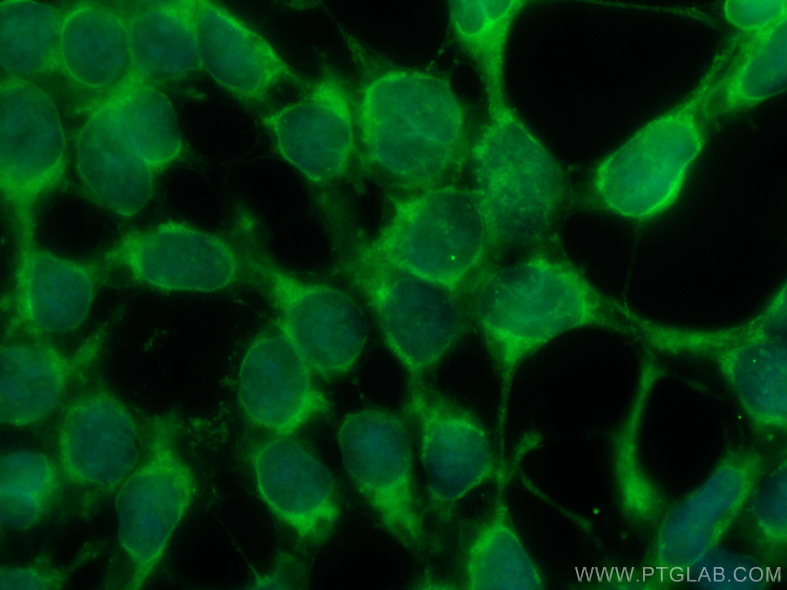 Immunofluorescence (IF) / fluorescent staining of HEK-293 cells using CoraLite® Plus 488-conjugated DMAP1 Monoclonal ant (CL488-67183)