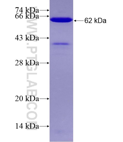 DMAP1 fusion protein Ag28906 SDS-PAGE