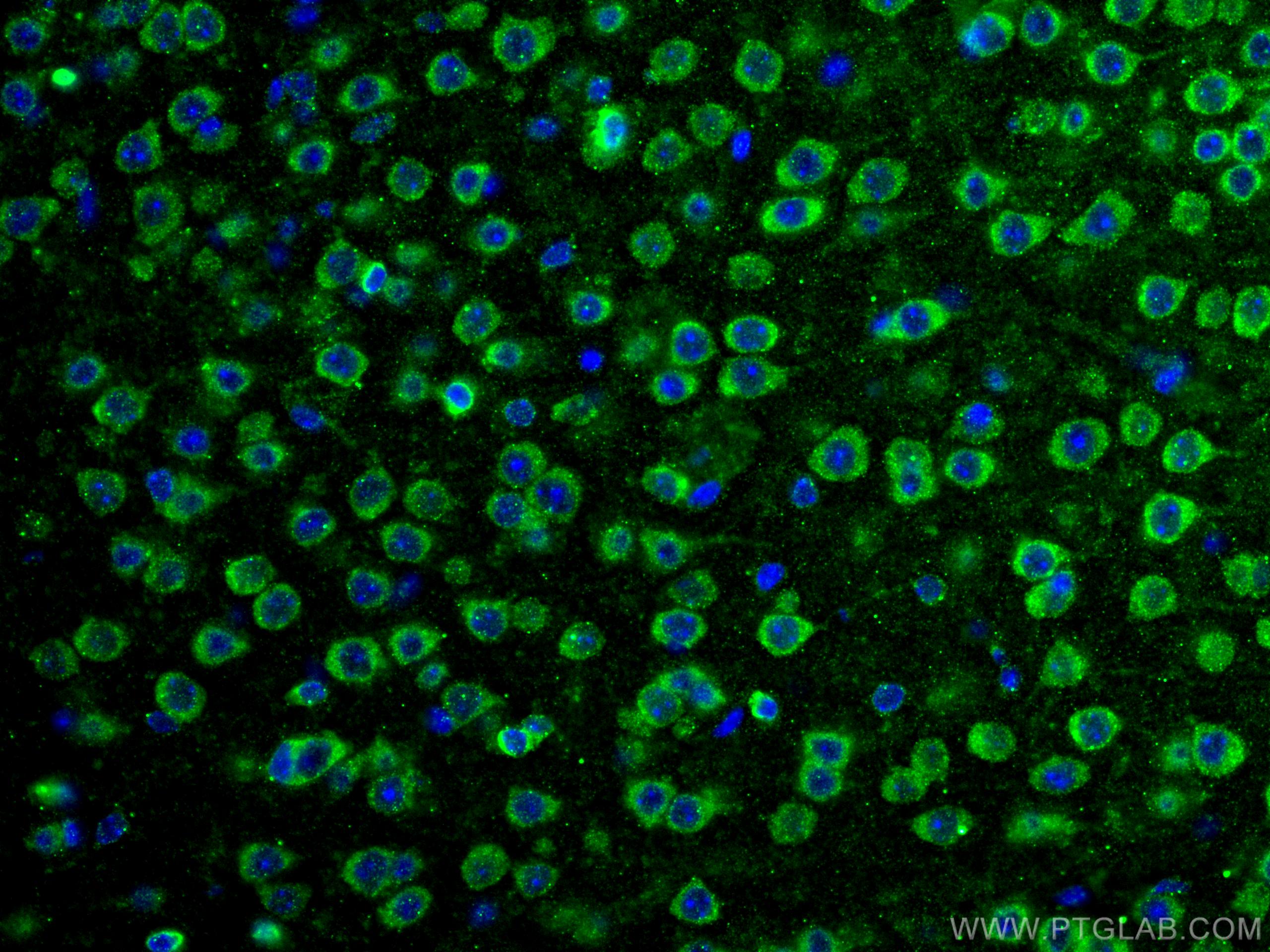 Immunofluorescence (IF) / fluorescent staining of human brain tissue using DMBT1 Polyclonal antibody (27069-1-AP)