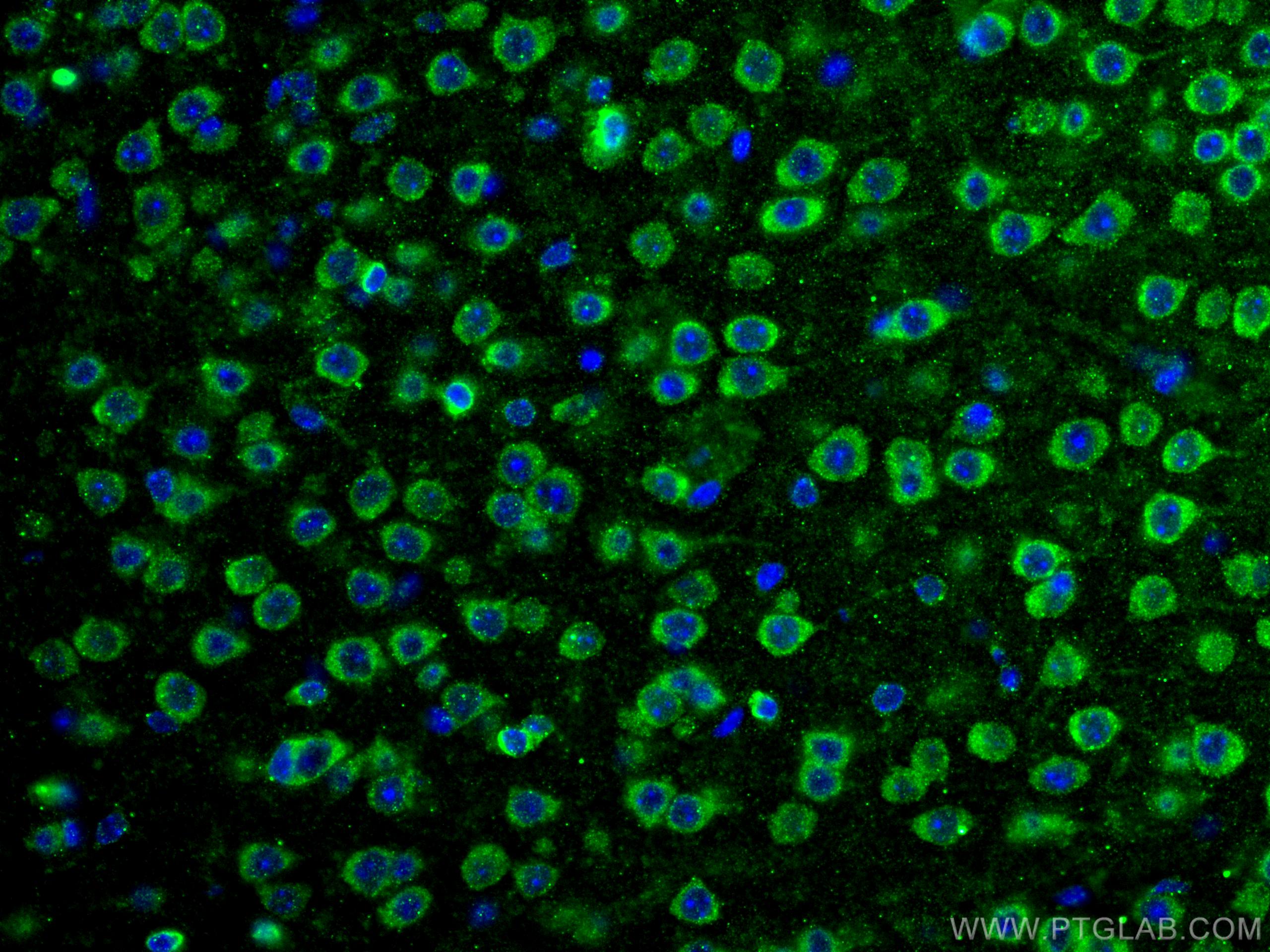 IF Staining of human brain using 27069-1-AP