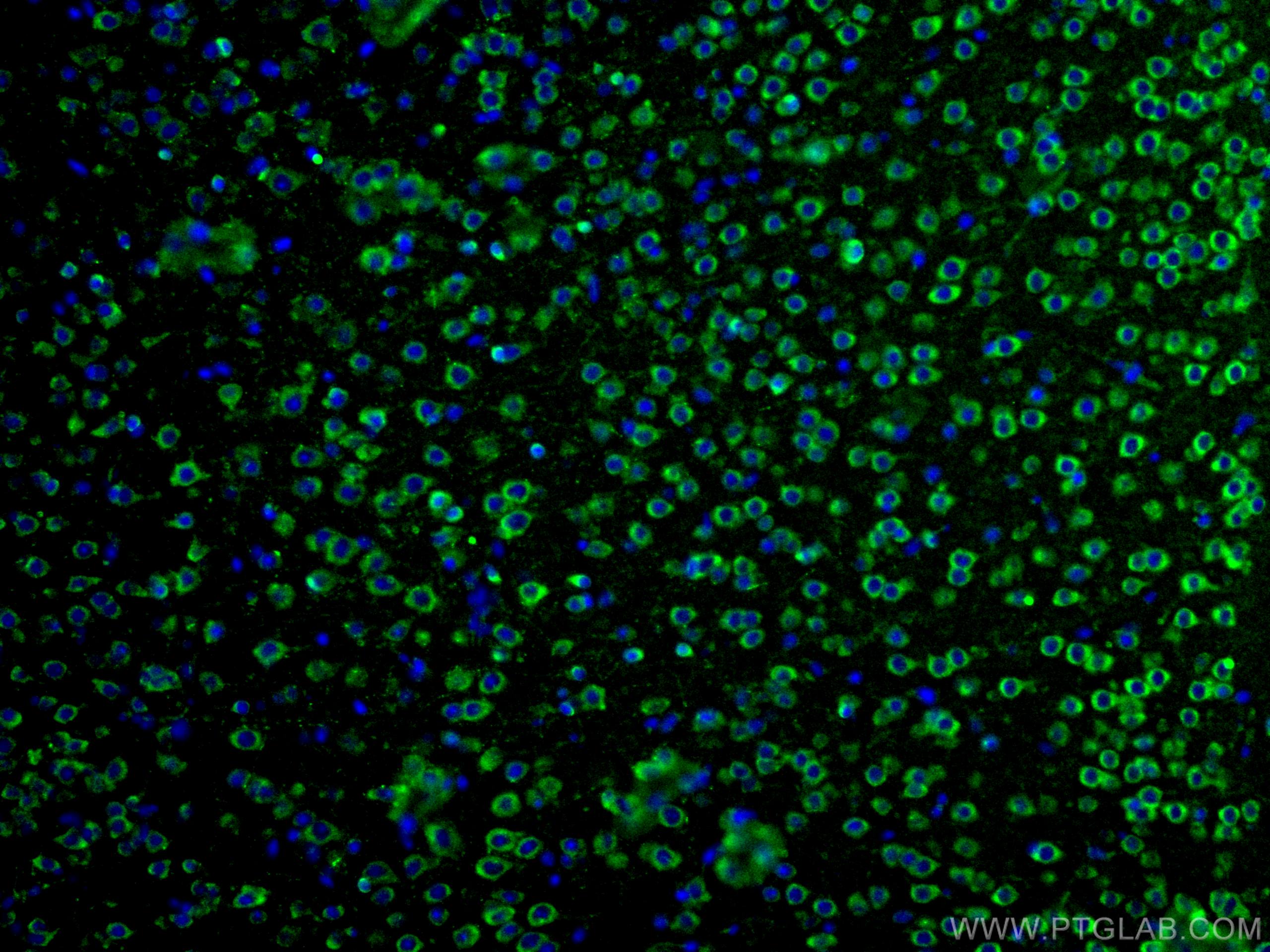 Immunofluorescence (IF) / fluorescent staining of human brain tissue using DMBT1 Polyclonal antibody (27069-1-AP)