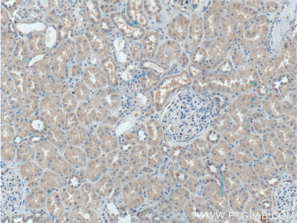 Immunohistochemistry (IHC) staining of human kidney tissue using DMBT1 Polyclonal antibody (27069-1-AP)