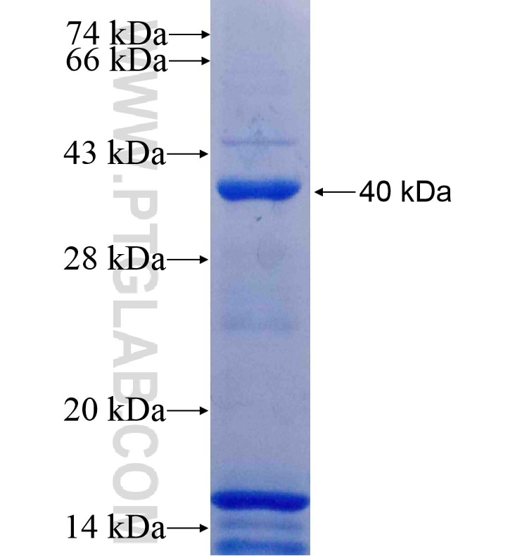 DMBT1 fusion protein Ag16229 SDS-PAGE