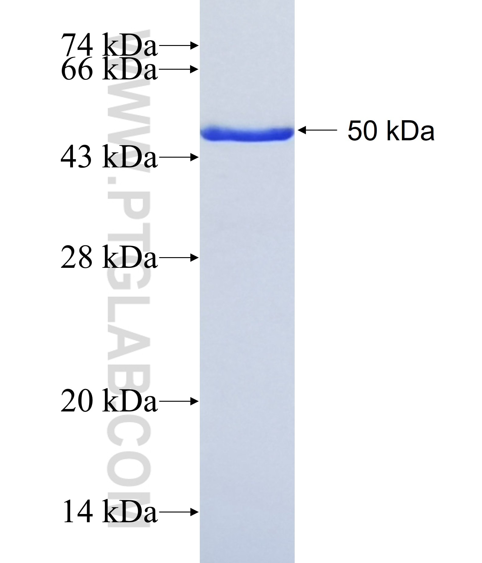 DMBX1 fusion protein Ag41356 SDS-PAGE DMBX1 fusion protein Ag41356 SDS-PAGE