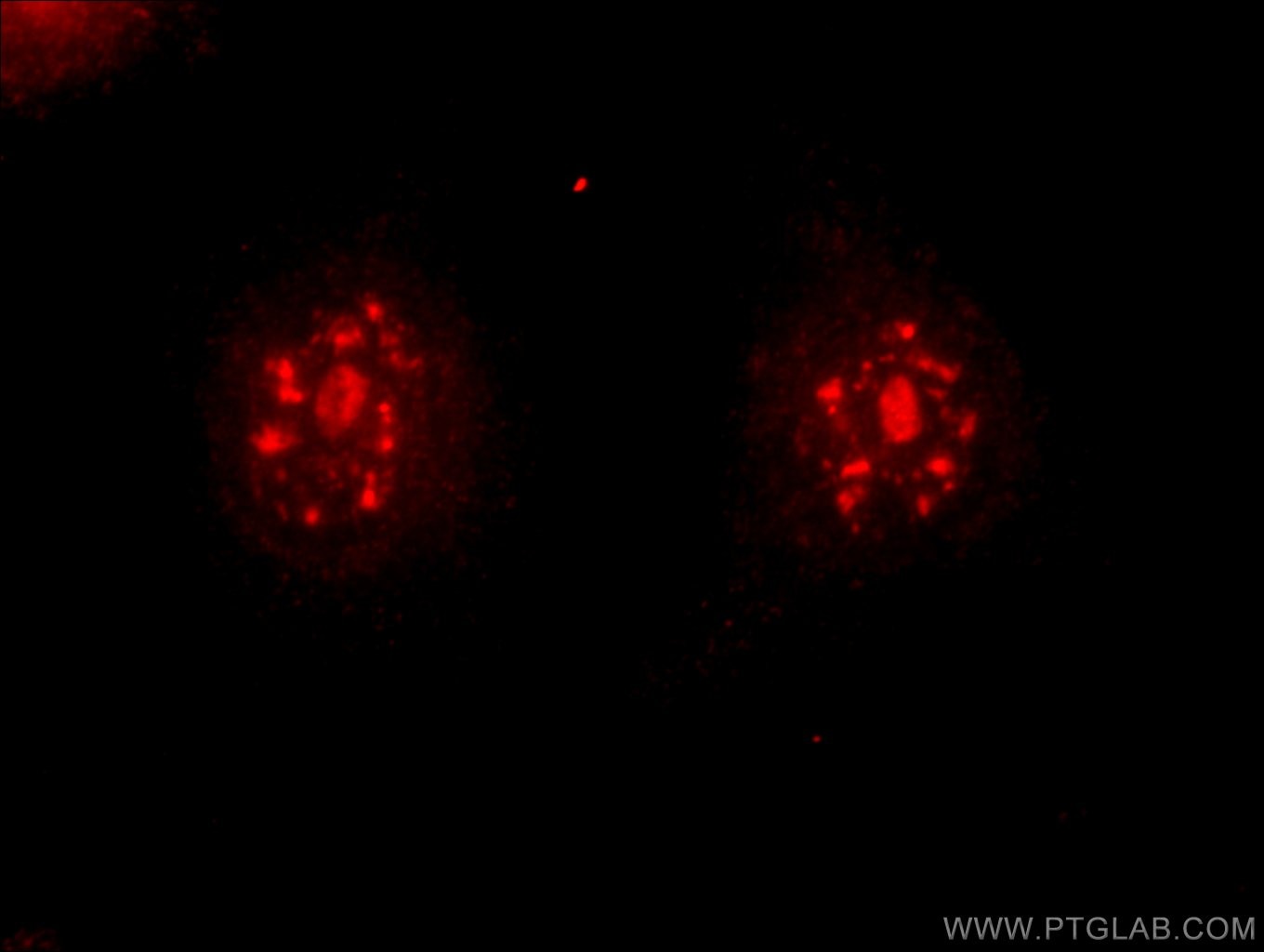 Immunofluorescence (IF) / fluorescent staining of HeLa cells using DMC1 Polyclonal antibody (13714-1-AP)