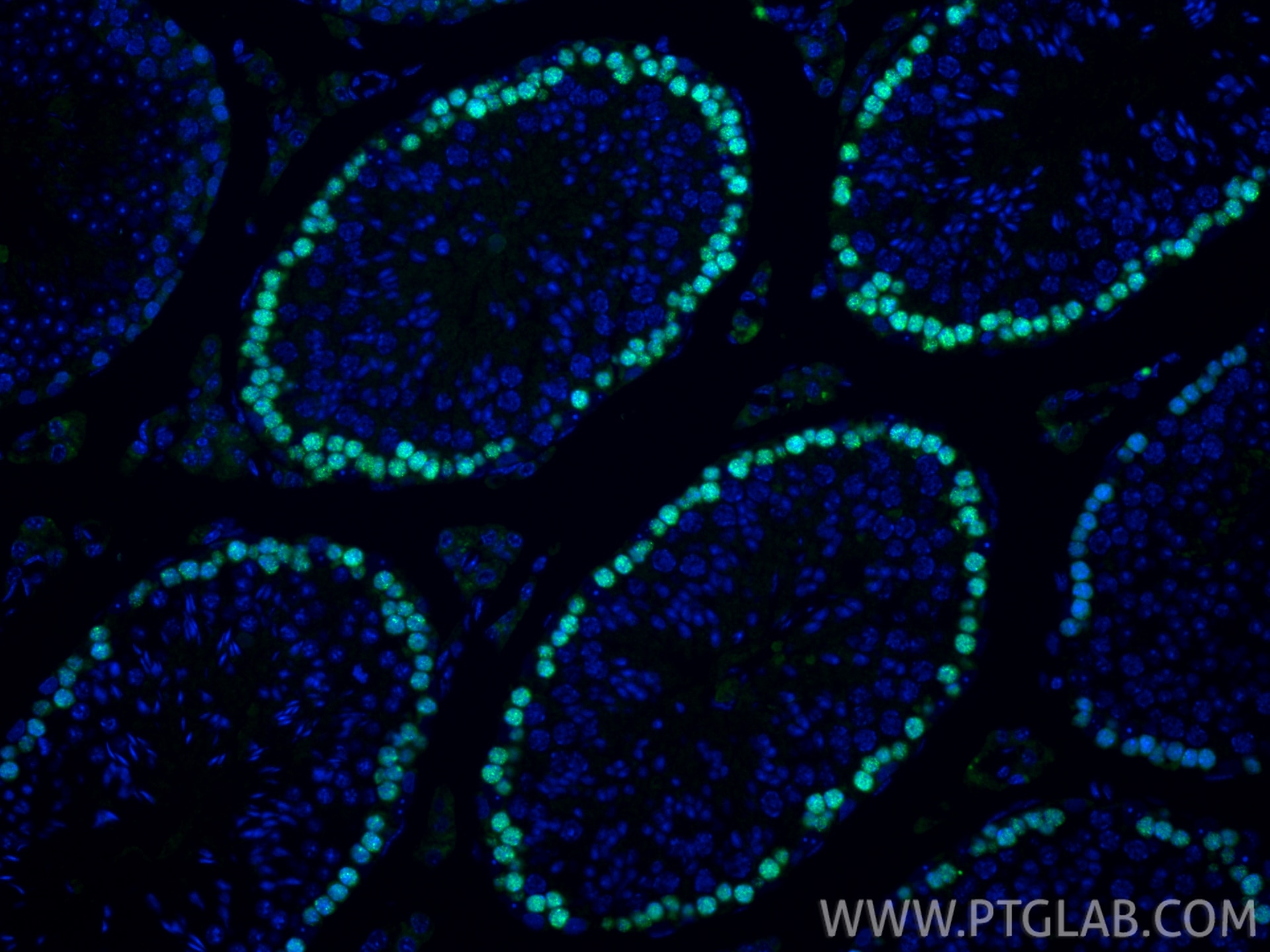 Immunofluorescence (IF) / fluorescent staining of mouse testis tissue using DMC1 Polyclonal antibody (13714-1-AP)