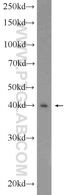 Western Blot (WB) analysis of HeLa cells using DMC1 Polyclonal antibody (13714-1-AP)