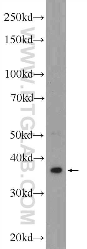 Western Blot (WB) analysis of human testis tissue using DMC1 Polyclonal antibody (13714-1-AP)