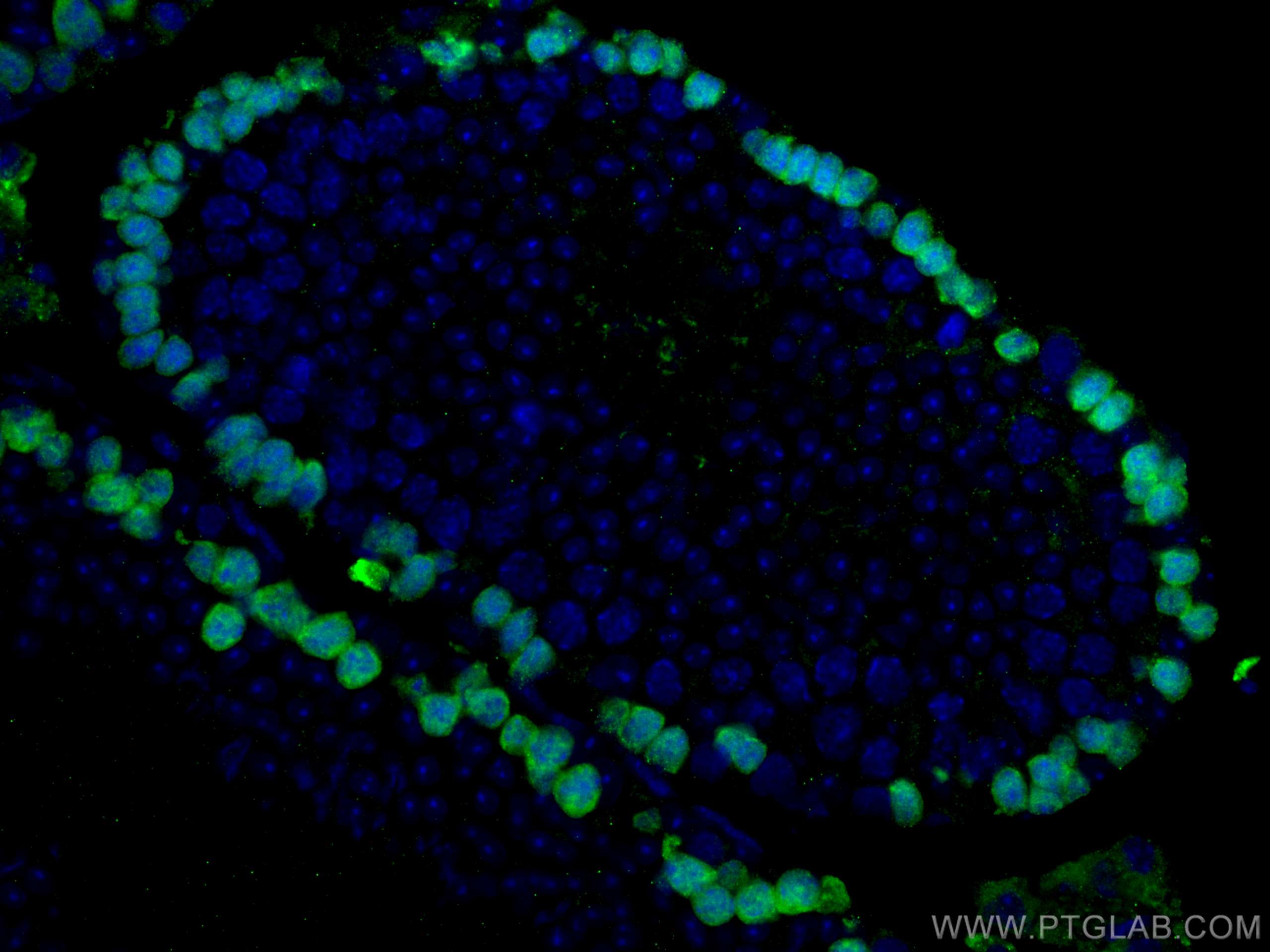 Immunofluorescence (IF) / fluorescent staining of mouse testis tissue using DMC1 Monoclonal antibody (67176-1-Ig)