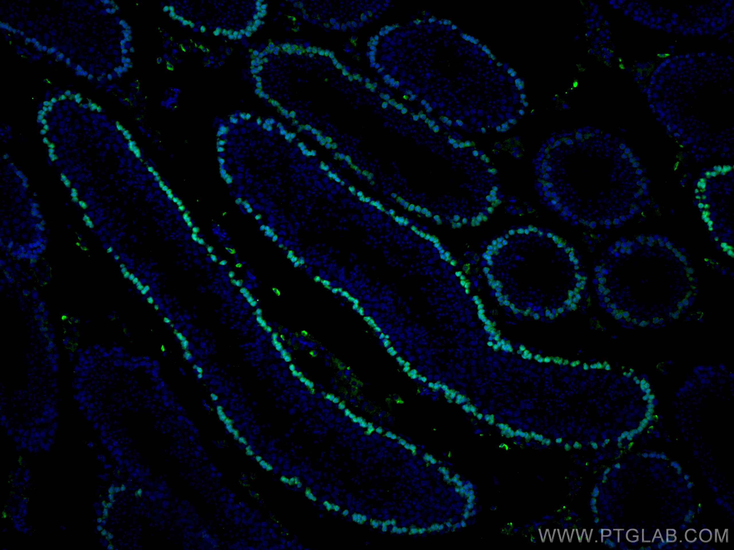 Immunofluorescence (IF) / fluorescent staining of mouse testis tissue using DMC1 Monoclonal antibody (67176-1-Ig)