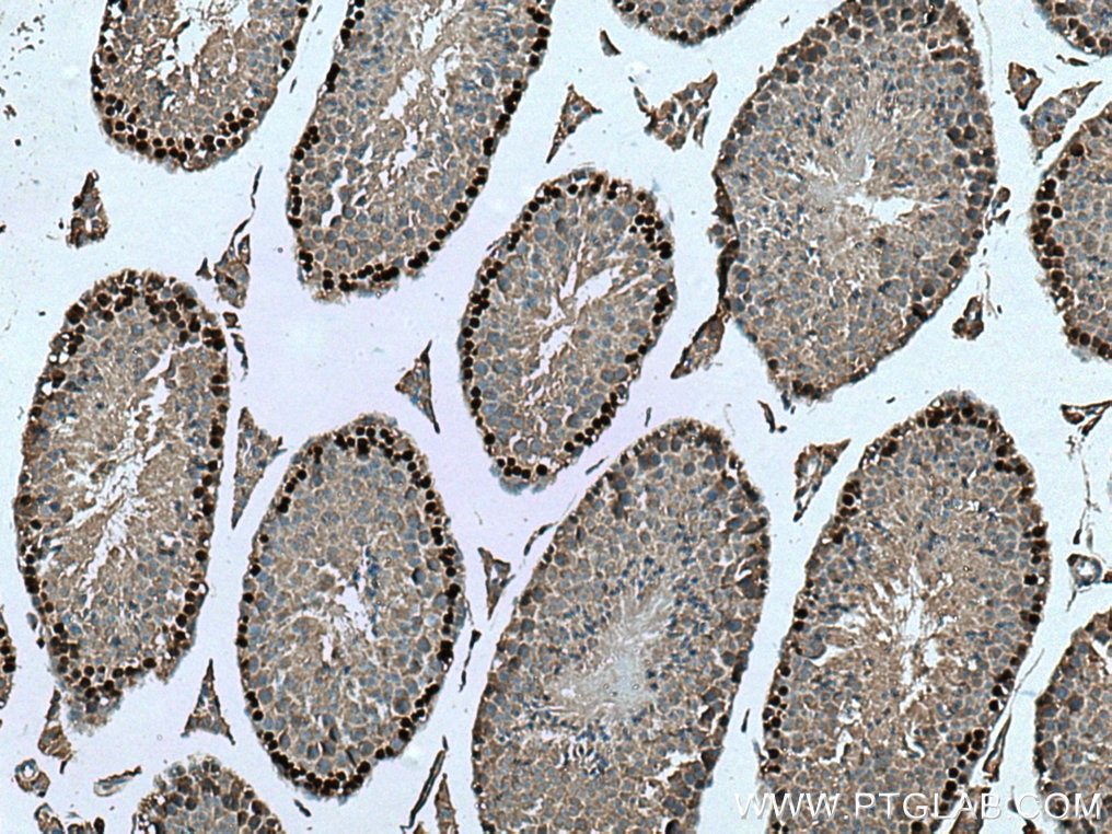 IHC staining of mouse testis using 67176-1-Ig