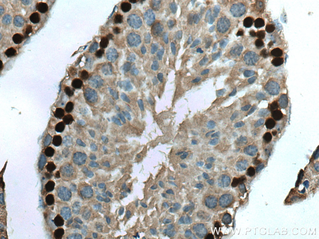 Immunohistochemistry (IHC) staining of mouse testis tissue using DMC1 Monoclonal antibody (67176-1-Ig)