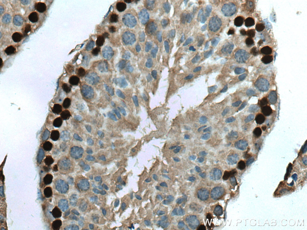 IHC staining of mouse testis using 67176-1-Ig