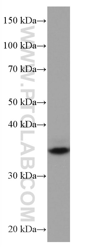 Western Blot (WB) analysis of Jurkat cells using DMC1 Monoclonal antibody (67176-1-Ig)