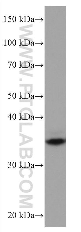 WB analysis of Jurkat using 67176-1-Ig