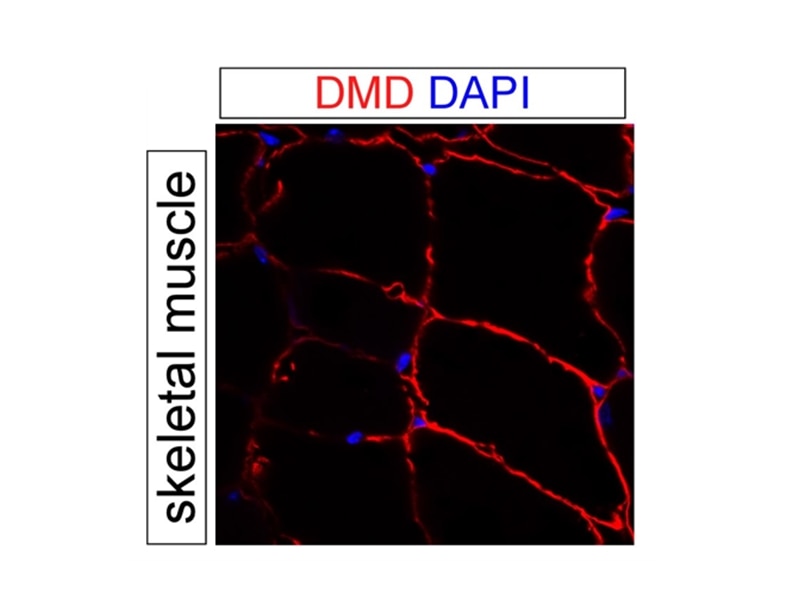 Dystrophin Polyclonal antibody