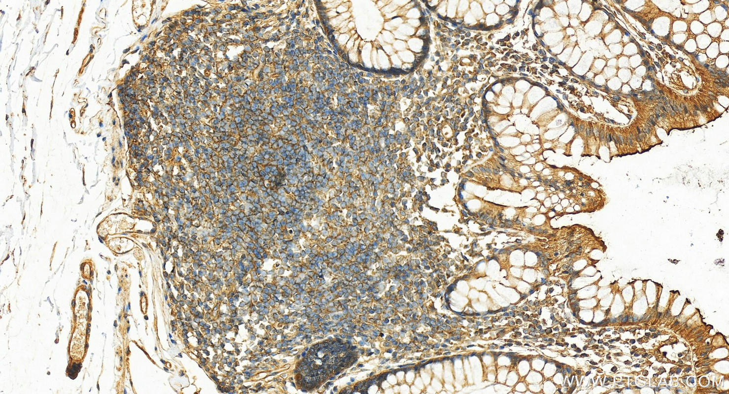 Immunohistochemistry (IHC) staining of human colon tissue using Dystrophin Polyclonal antibody (12715-1-AP)