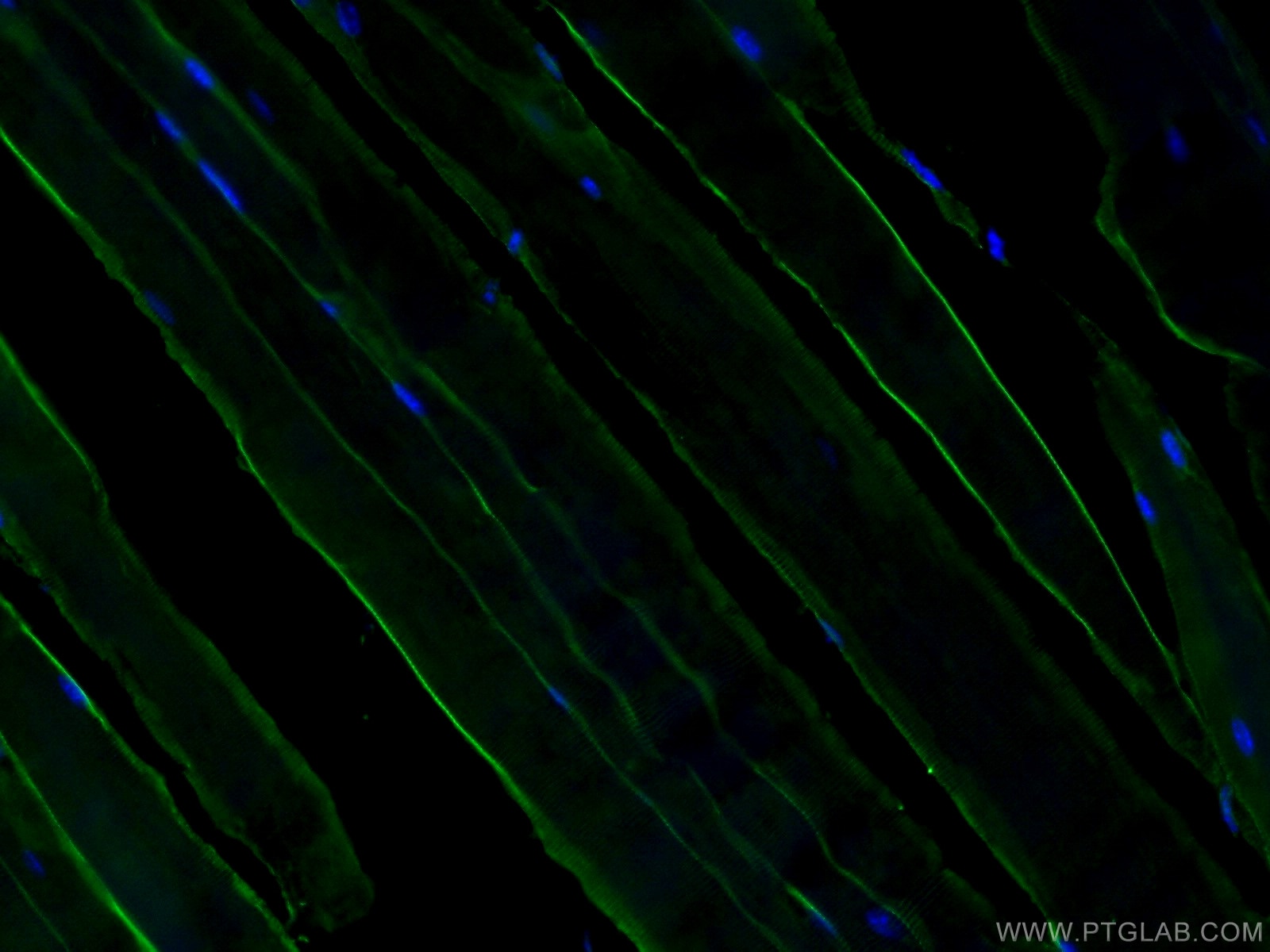 Dystrophin