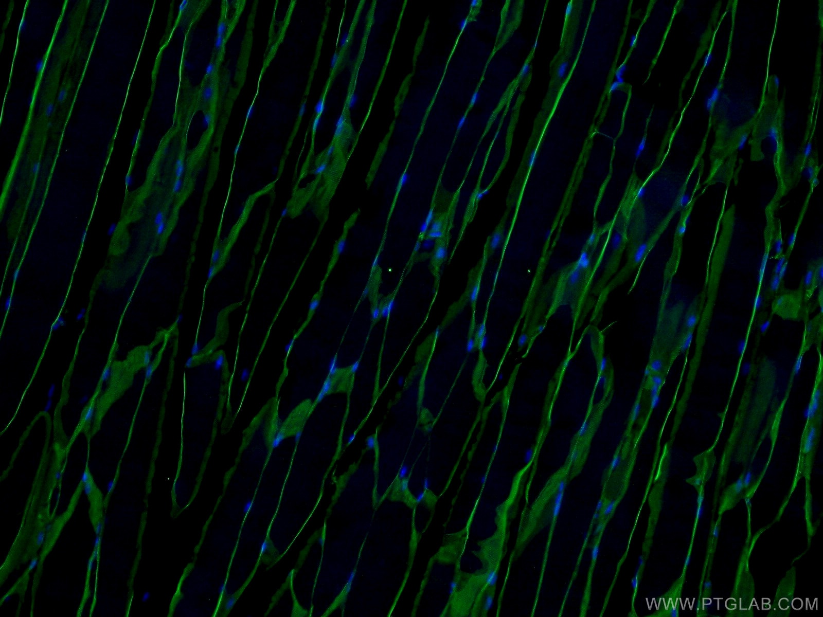 Immunofluorescence (IF) / fluorescent staining of mouse skeletal muscle tissue using Dystrophin Polyclonal antibody (12715-1-AP)