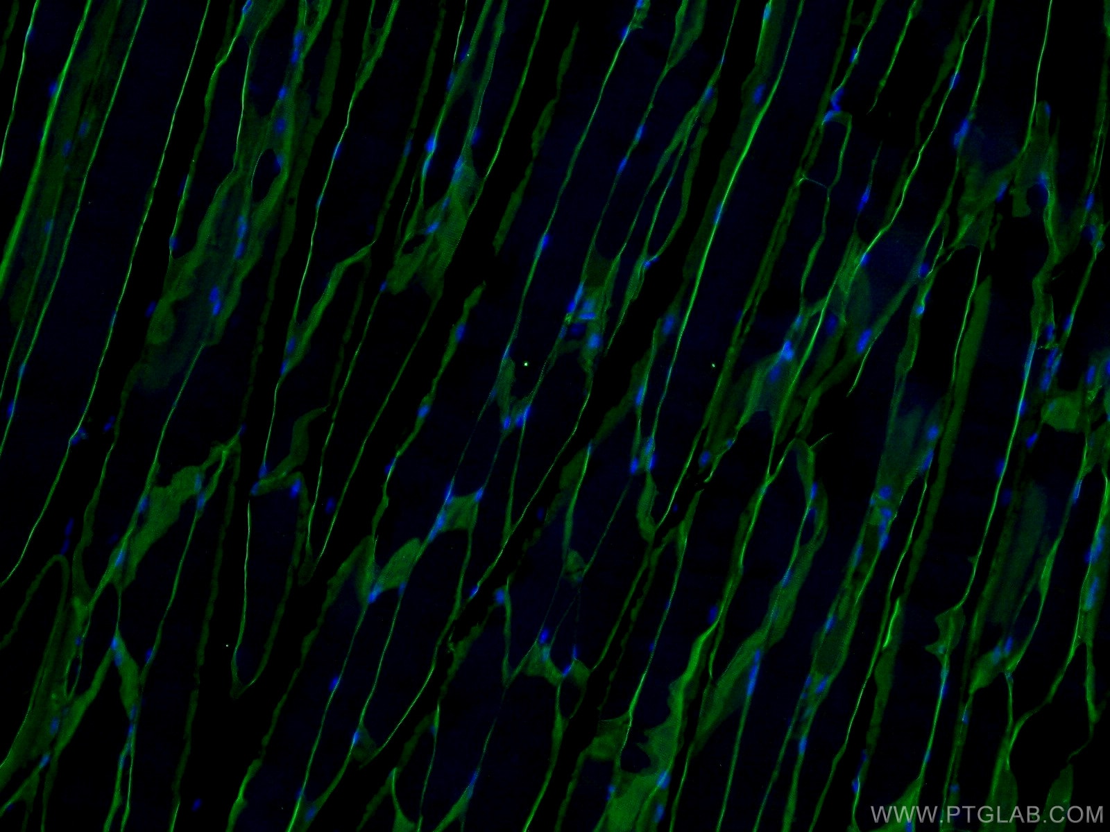 IF Staining of mouse skeletal muscle using 12715-1-AP