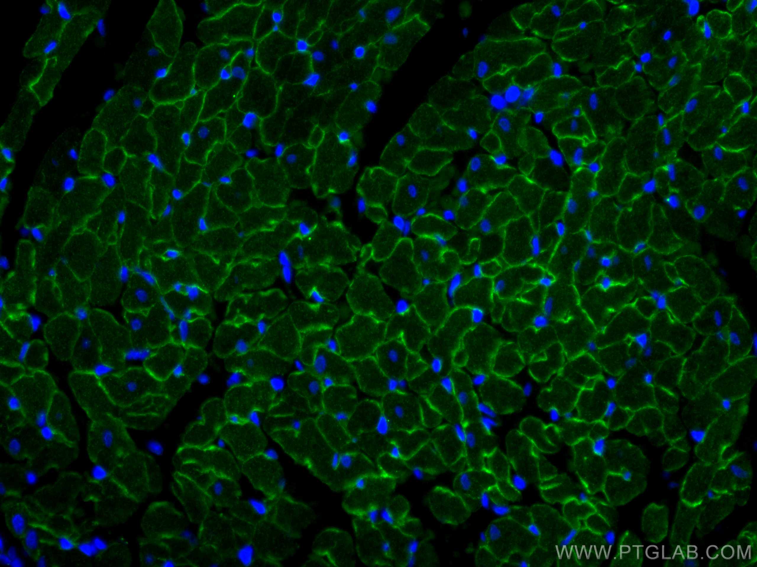 Immunofluorescence (IF) / fluorescent staining of rat heart tissue using Dystrophin Polyclonal antibody (12715-1-AP)
