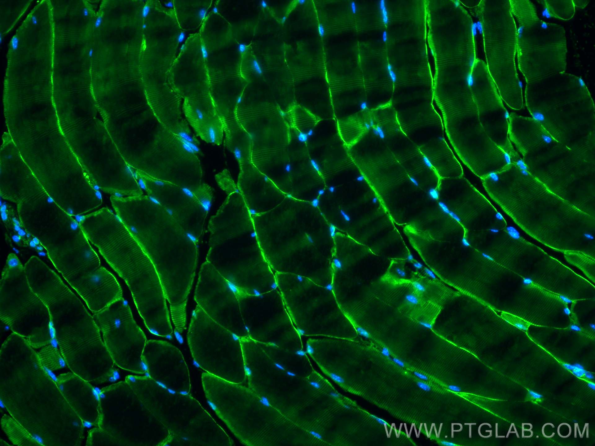 Immunofluorescence (IF) / fluorescent staining of mouse skeletal muscle tissue using Dystrophin Polyclonal antibody (12715-1-AP)