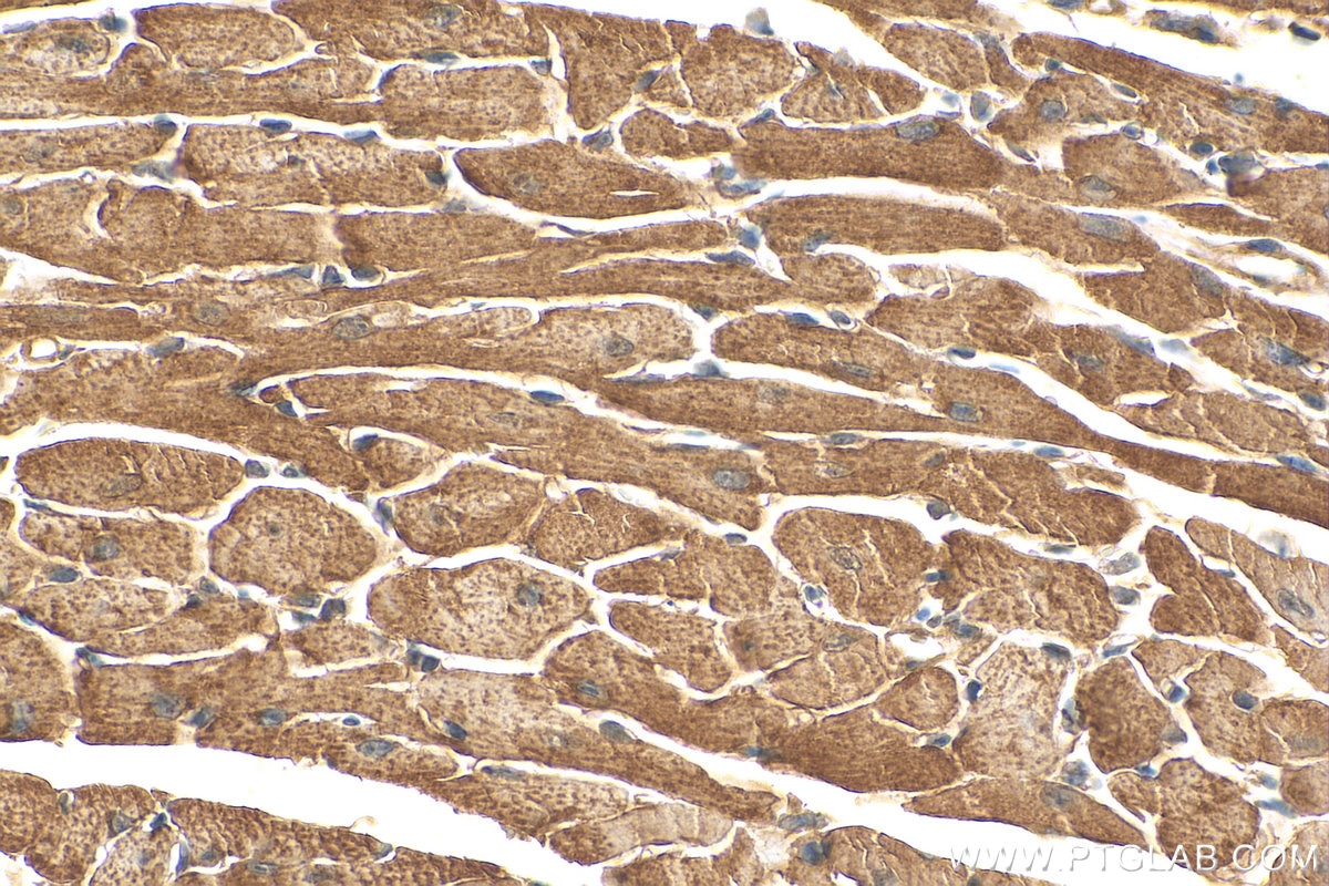 Immunohistochemistry (IHC) staining of mouse heart tissue using Dystrophin Polyclonal antibody (12715-1-AP)