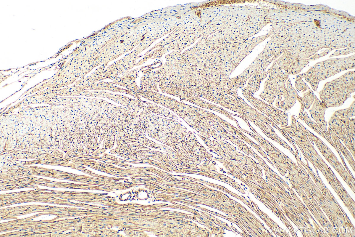 Immunohistochemistry (IHC) staining of mouse heart tissue using Dystrophin Polyclonal antibody (12715-1-AP)