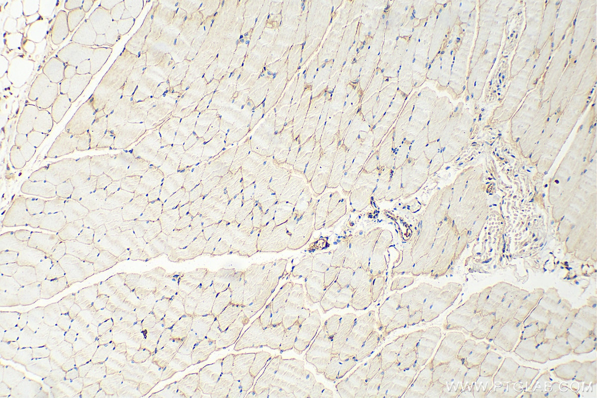 Immunohistochemistry (IHC) staining of mouse skeletal muscle tissue using Dystrophin Polyclonal antibody (12715-1-AP)