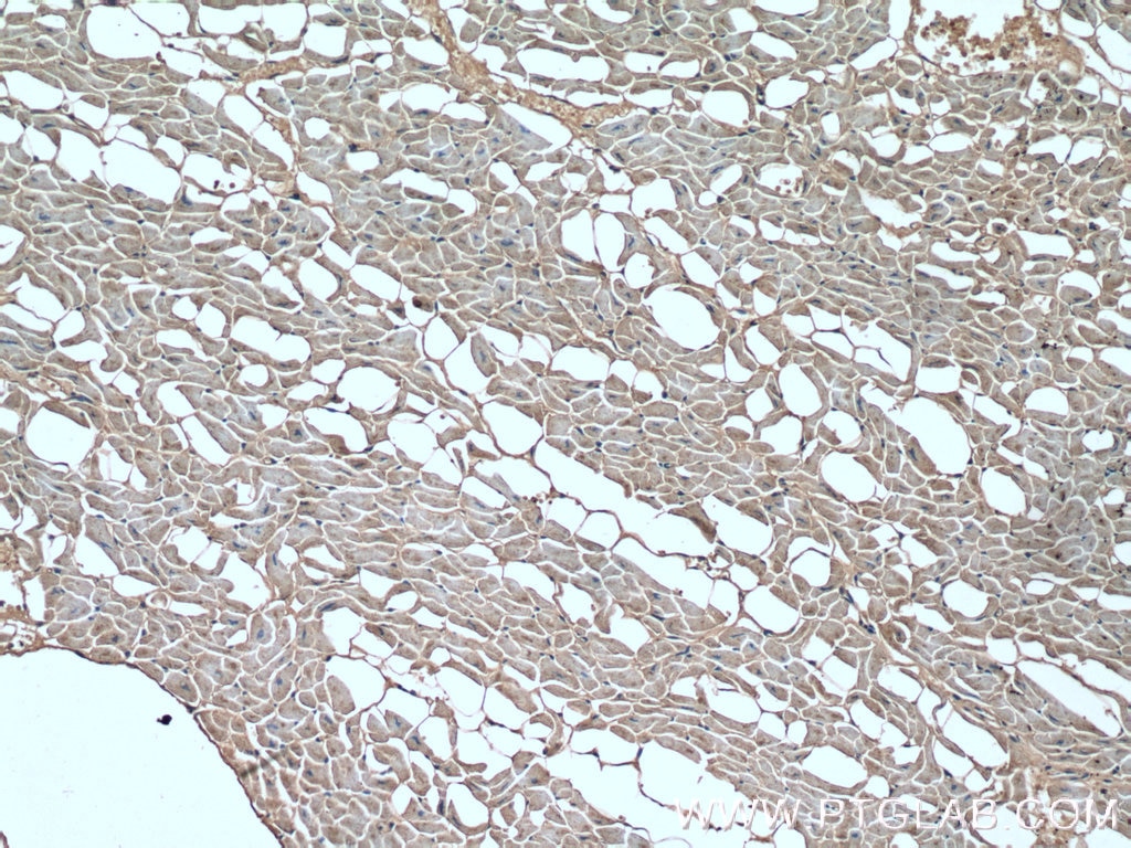 Immunohistochemistry (IHC) staining of human heart tissue using Dystrophin Polyclonal antibody (12715-1-AP)