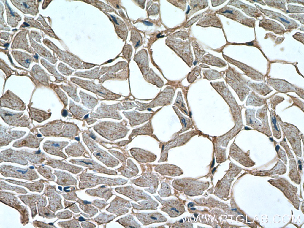 Immunohistochemistry (IHC) staining of human heart tissue using Dystrophin Polyclonal antibody (12715-1-AP)