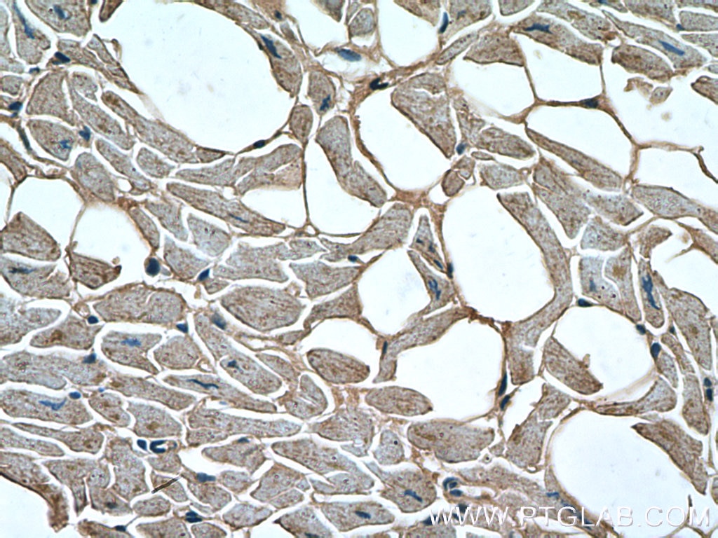 IHC staining of human heart using 12715-1-AP