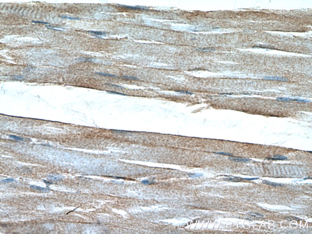 Immunohistochemistry (IHC) staining of human skeletal muscle tissue using Dystrophin Polyclonal antibody (12715-1-AP)