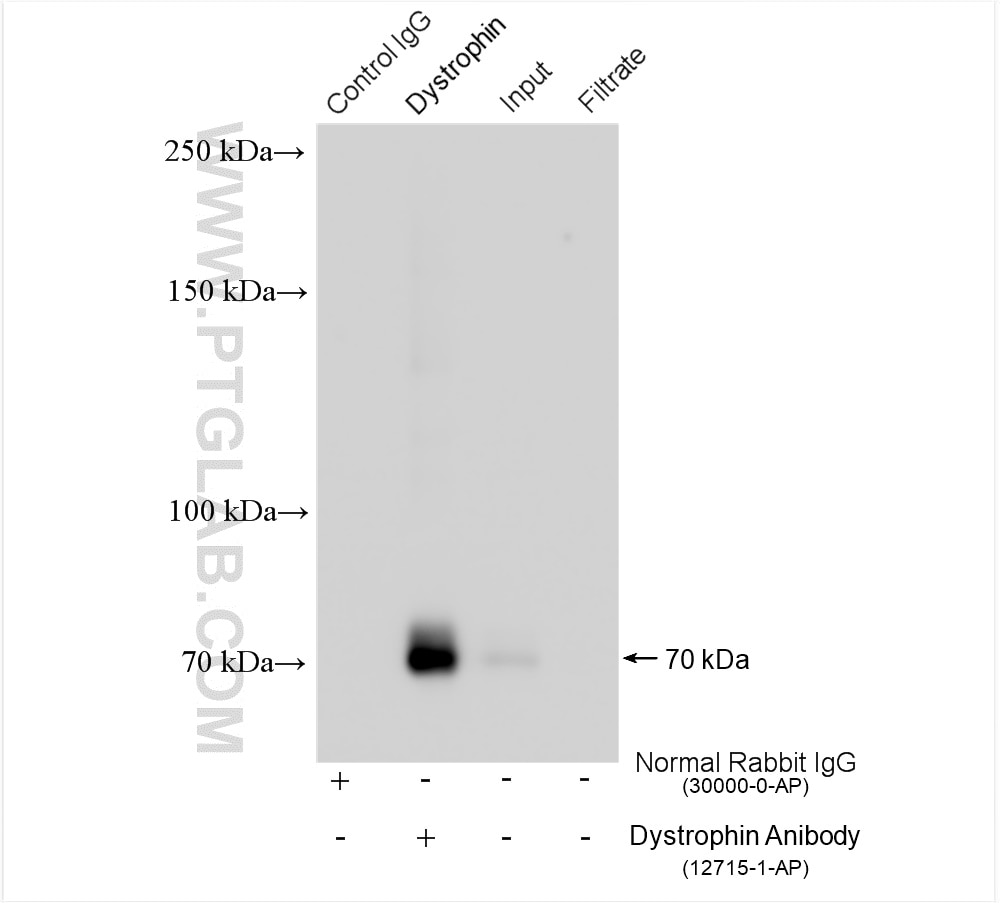 Immunoprecipitation (IP) experiment of mouse brain tissue using Dystrophin Polyclonal antibody (12715-1-AP)