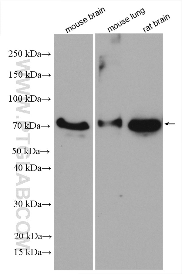 Western Blot (WB) analysis of various lysates using Dystrophin Polyclonal antibody (12715-1-AP)