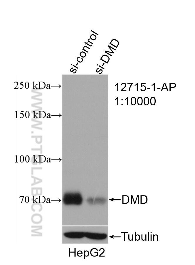 Western Blot (WB) analysis of HepG2 cells using Dystrophin Polyclonal antibody (12715-1-AP)